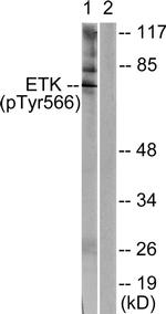 Phospho-ETK (Tyr566) Antibody in Western Blot (WB)