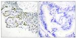 Phospho-PKC delta (Tyr52) Antibody in Immunohistochemistry (Paraffin) (IHC (P))