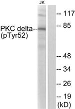 Phospho-PKC delta (Tyr52) Antibody in Western Blot (WB)