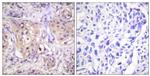 Phospho-PKC Pan (Thr497) Antibody in Immunohistochemistry (Paraffin) (IHC (P))