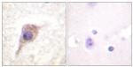 Phospho-PKC zeta (Thr560) Antibody in Immunohistochemistry (Paraffin) (IHC (P))