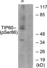 Phospho-TIP60 (Ser86) Antibody in Western Blot (WB)