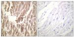 Phospho-Cardiac Troponin I (Ser43) Antibody in Immunohistochemistry (Paraffin) (IHC (P))