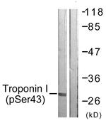 Phospho-Cardiac Troponin I (Ser43) Antibody in Western Blot (WB)