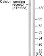 Phospho-Calcium Sensing Receptor (Thr888) Antibody in Western Blot (WB)