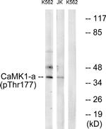 Phospho-CaMKI (Thr177) Antibody in Western Blot (WB)