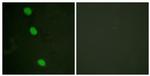 Phospho-CaMKIV (Thr196, Thr200) Antibody in Immunocytochemistry (ICC/IF)