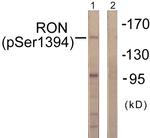 Phospho-RON (Ser1394) Antibody in Western Blot (WB)