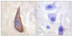 Phospho-CD226 (Ser329) Antibody in Immunohistochemistry (Paraffin) (IHC (P))