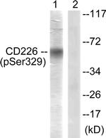 Phospho-CD226 (Ser329) Antibody in Western Blot (WB)