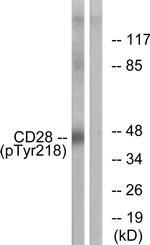 Phospho-CD28 (Tyr218) Antibody in Western Blot (WB)