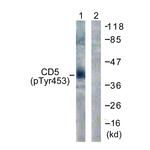 Phospho-CD5 (Tyr453) Antibody in Western Blot (WB)