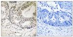 Phospho-53BP1 (Ser25) Antibody in Immunohistochemistry (Paraffin) (IHC (P))