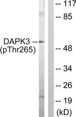 Phospho-ZIPK (Thr265) Antibody in Western Blot (WB)