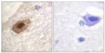 Phospho-DDX3 (Thr322) Antibody in Immunohistochemistry (Paraffin) (IHC (P))