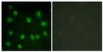 Dematin Antibody in Immunocytochemistry (ICC/IF)