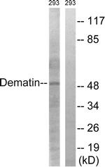 Dematin Antibody in Western Blot (WB)