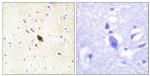 Phospho-DNA-PK (Ser2612) Antibody in Immunohistochemistry (Paraffin) (IHC (P))