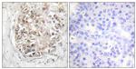 Phospho-DNA-PK (Ser2056) Antibody in Immunohistochemistry (Paraffin) (IHC (P))
