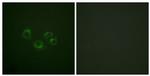 EphA2/EphA3/EphA4 Antibody in Immunocytochemistry (ICC/IF)