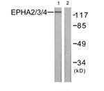 EphA2/EphA3/EphA4 Antibody in Western Blot (WB)