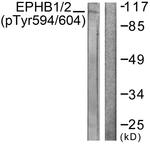 Phospho-EphB1/EphB2 (Tyr594, Tyr604) Antibody in Western Blot (WB)