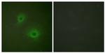 EphB1/EphB2 Antibody in Immunocytochemistry (ICC/IF)