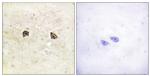 EphB1/EphB2 Antibody in Immunohistochemistry (Paraffin) (IHC (P))