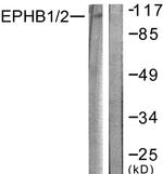 EphB1/EphB2 Antibody in Western Blot (WB)