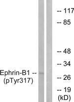 Phospho-Ephrin B1 (Tyr317) Antibody in Western Blot (WB)