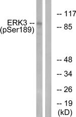 Phospho-ERK3 (Ser189) Antibody in Western Blot (WB)
