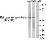 Phospho-Estrogen Receptor beta (Ser105) Antibody in Western Blot (WB)