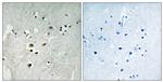 Phospho-ELK3 (Ser357) Antibody in Immunohistochemistry (Paraffin) (IHC (P))