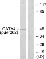 Phospho-GATA4 (Ser262) Antibody in Western Blot (WB)