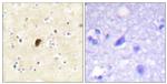 Phospho-GluR4 (Ser862) Antibody in Immunohistochemistry (Paraffin) (IHC (P))