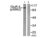 Phospho-GluR4 (Ser862) Antibody in Western Blot (WB)