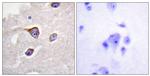 Phospho-GRK1 (Ser21) Antibody in Immunohistochemistry (Paraffin) (IHC (P))