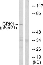 Phospho-GRK1 (Ser21) Antibody in Western Blot (WB)