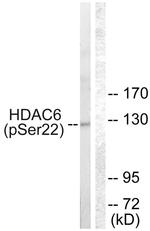 Phospho-HDAC6 (Ser22) Antibody in Western Blot (WB)