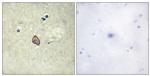 Phospho-ErbB3 (Tyr1328) Antibody in Immunohistochemistry (Paraffin) (IHC (P))