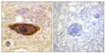 IFNAR1 Antibody in Immunohistochemistry (Paraffin) (IHC (P))