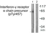 Phospho-IFNGR1 (Tyr457) Antibody in Western Blot (WB)