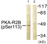 Phospho-PRKAR2B (Ser113) Antibody in Western Blot (WB)