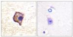 RET Antibody in Immunohistochemistry (Paraffin) (IHC (P))