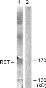 RET Antibody in Western Blot (WB)