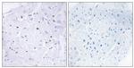 Phospho-SMAD3 (Thr179) Antibody in Immunohistochemistry (Paraffin) (IHC (P))