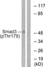 Phospho-SMAD3 (Thr179) Antibody in Western Blot (WB)