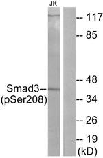 Phospho-SMAD3 (Ser208) Antibody in Western Blot (WB)