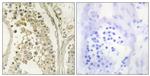MAST4 Antibody in Immunohistochemistry (Paraffin) (IHC (P))