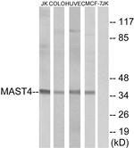 MAST4 Antibody in Western Blot (WB)
